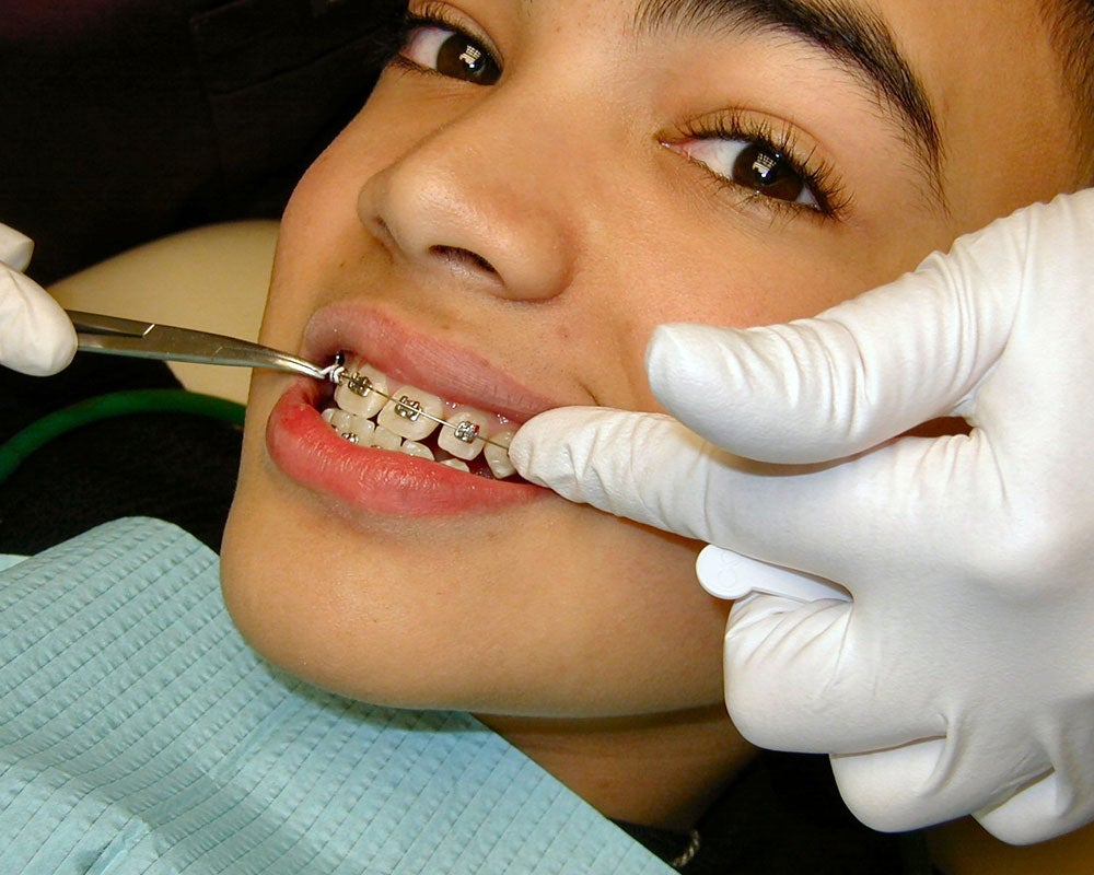 dentist working on child's braces