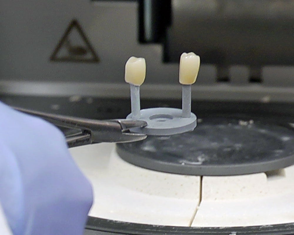 Crowns being created in a lab