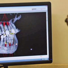 computer screen showing x-ray of someone's mouth