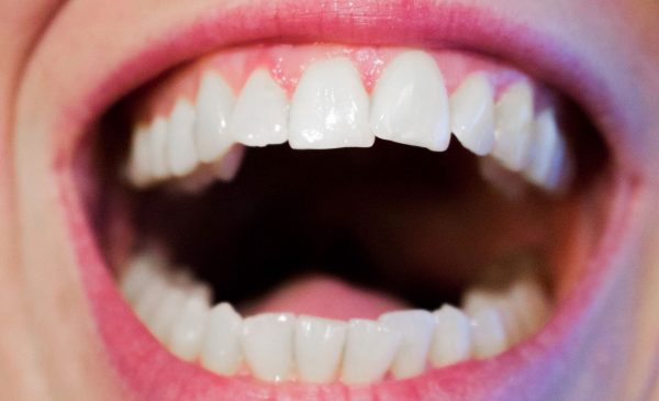 UIC Researchers Find Connection Between Alzheimer’s and Gum Disease