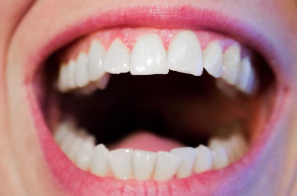 UIC Researchers Find Connection Between Alzheimer’s and Gum Disease