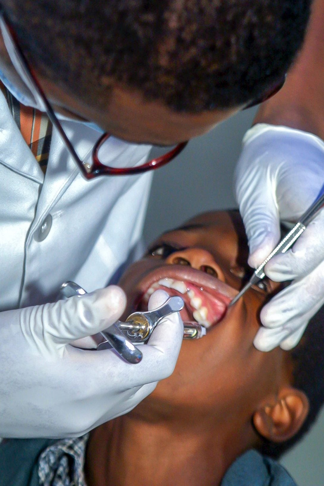 dentist using dental tool to look into child's mouth