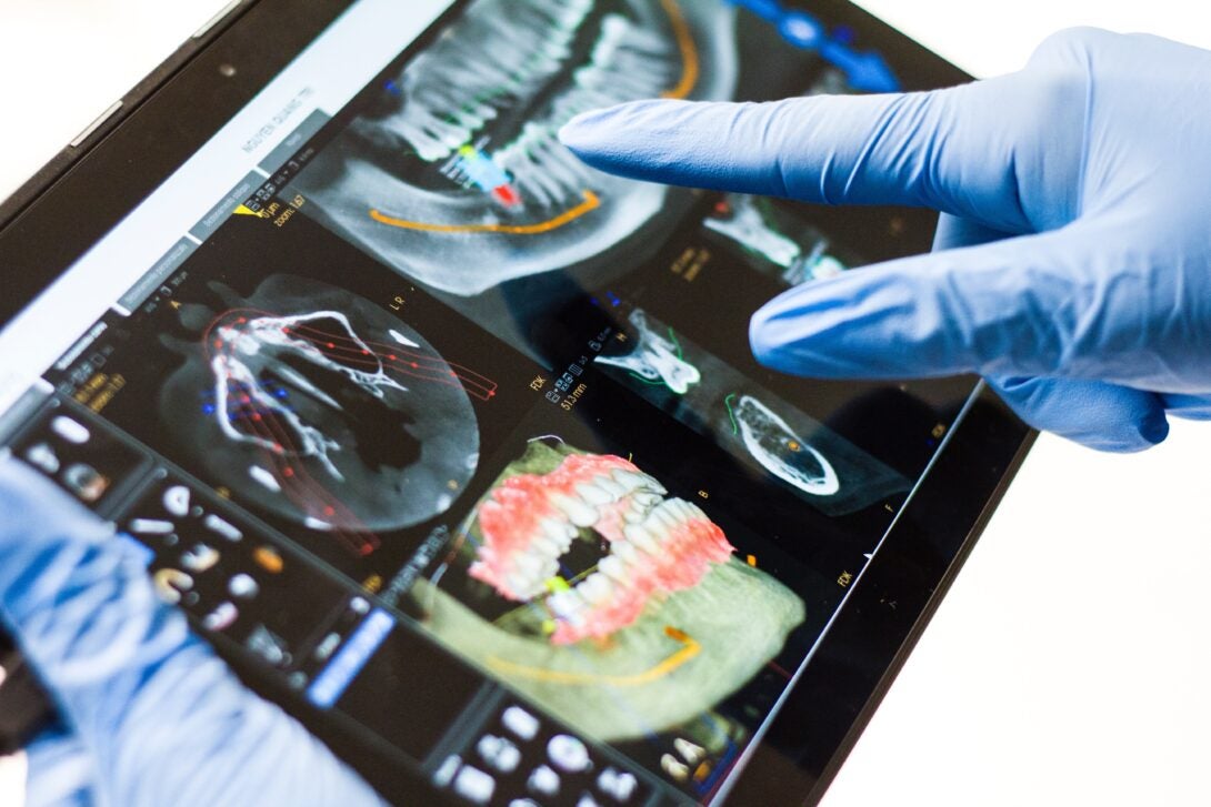 Digital screen of an x-ray of a person's teeth and mouth